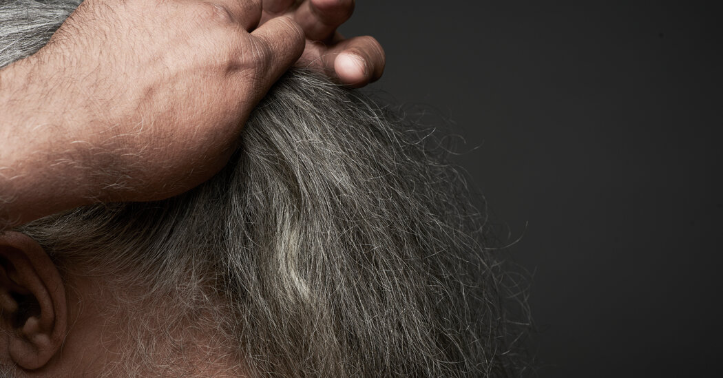 Your Hair Is Heading Gray. This Glitch May Explain Why.