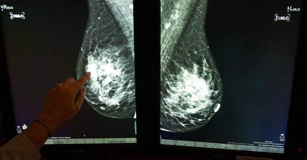 Researchers Identify Possible New Danger for Breast Cancer