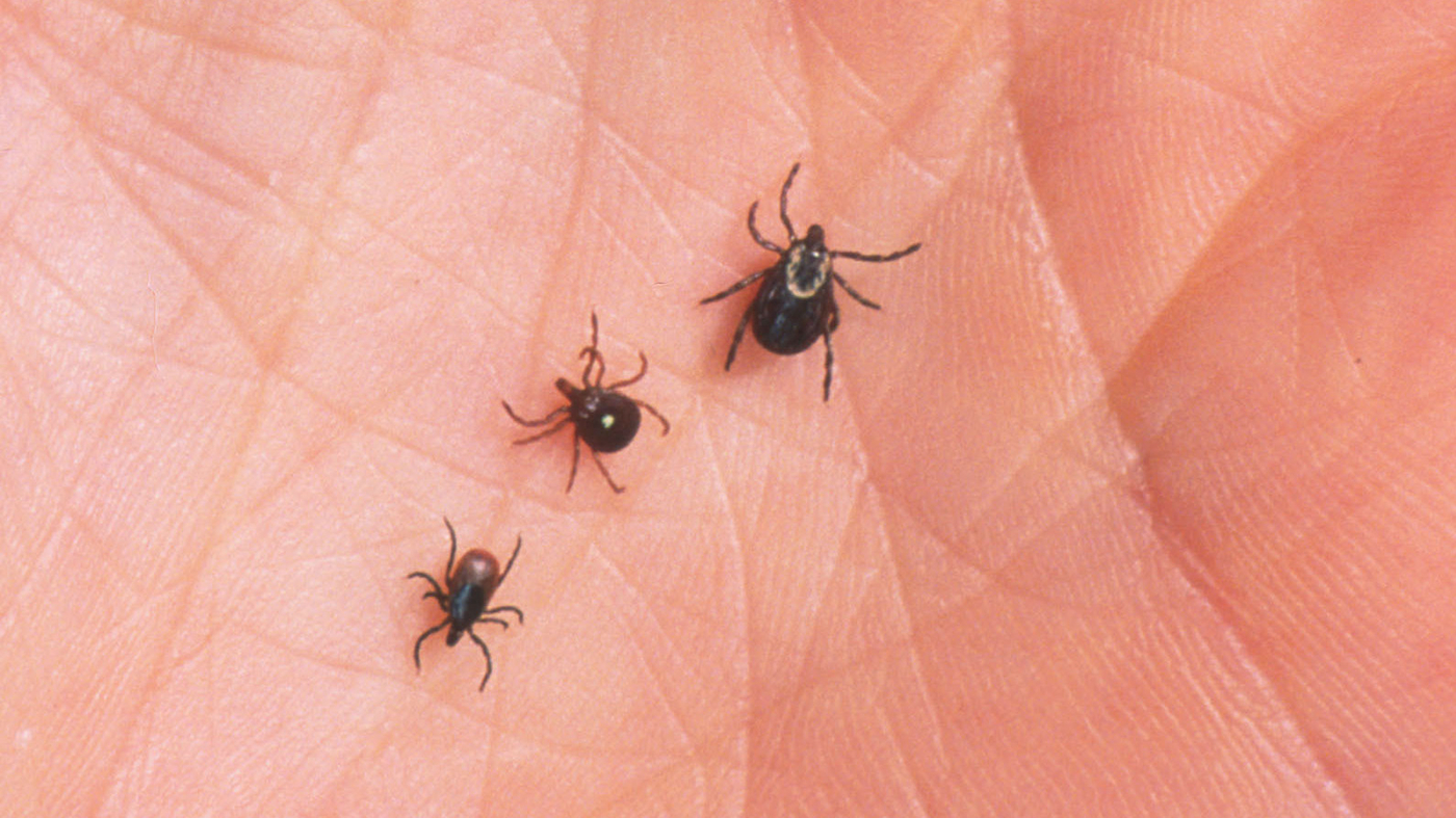 Red meat allergy caused by ticks may cause digestive symptoms only : Shots