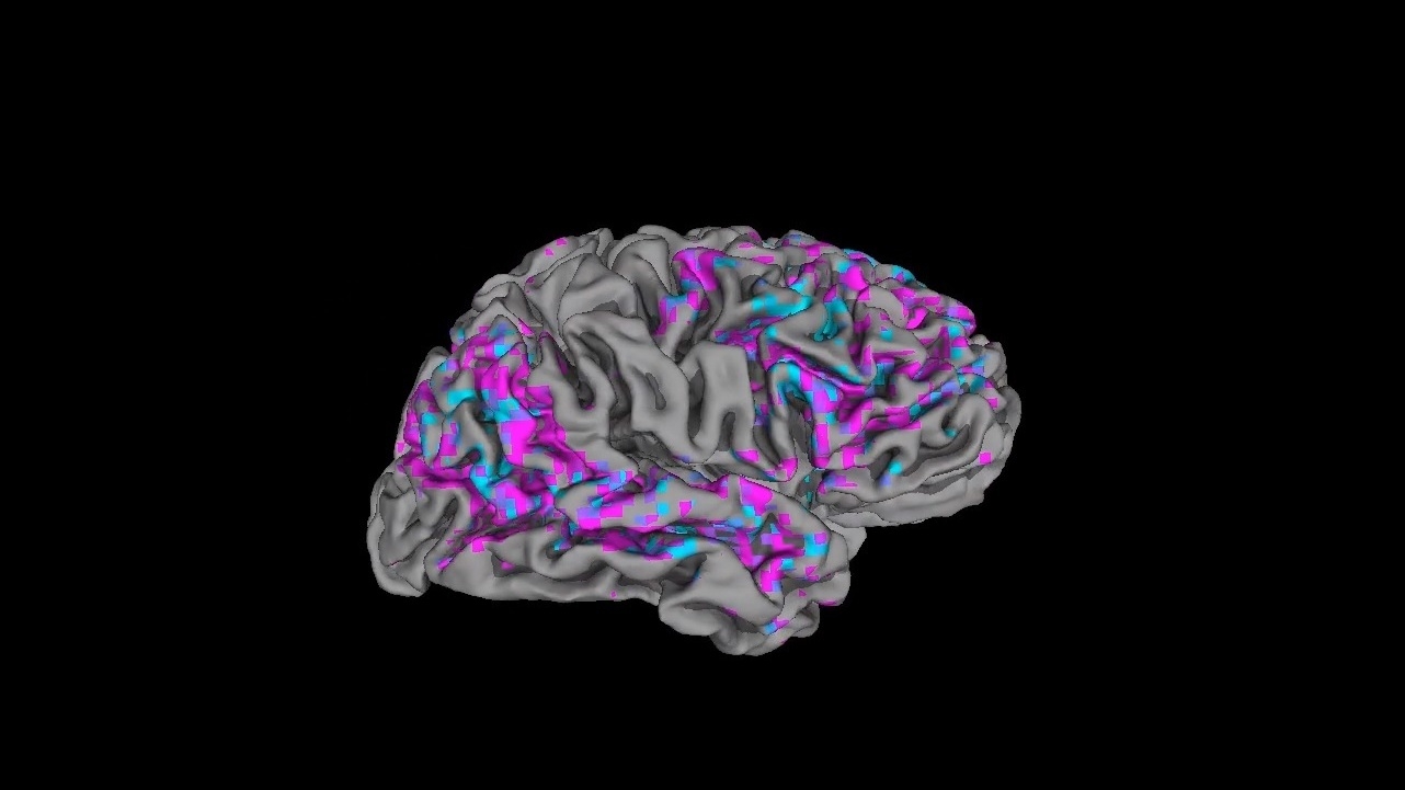 Scientists use fMRI and AI to decode language indicators in the mind : Pictures