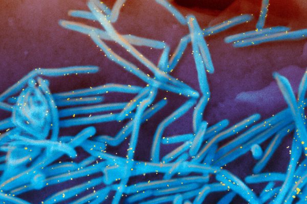 Fda Approves Pfizer’s RSV Vaccine for Grownups 60 and Older