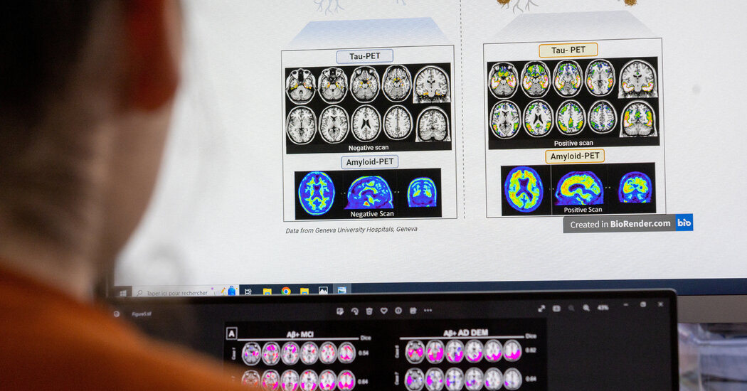 What to Know About Leqembi, the Alzheimer’s Drug Permitted by the Food and drug administration