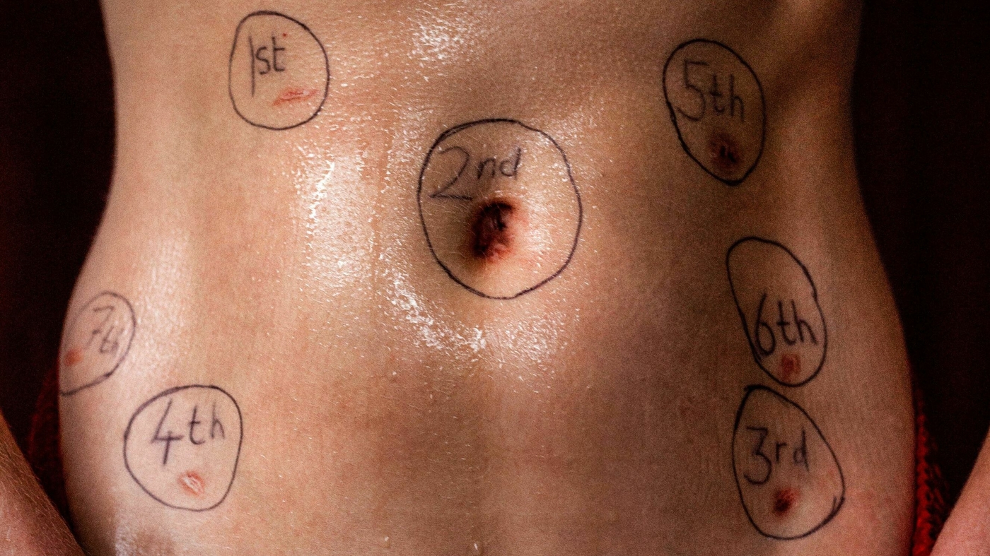 7 takeaways from ‘Below the Belt,’ a new film about endometriosis : Shots