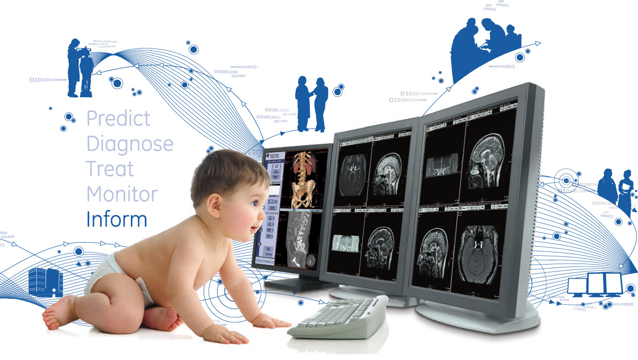 Global Advanced Baby Monitors Market Share & Upcoming Industry Growth | Report Covers Industry Insights on Regional Competition