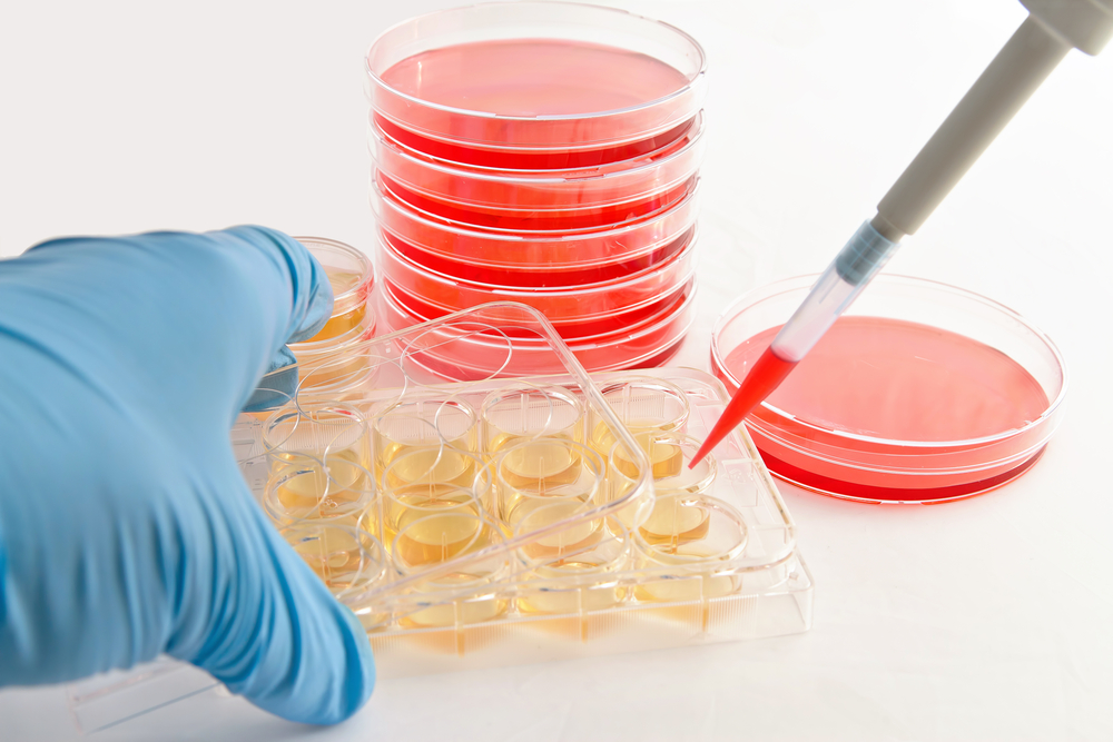 Why Automated Cell Culture Market Trends Expanding Moderately? Answers Our Report