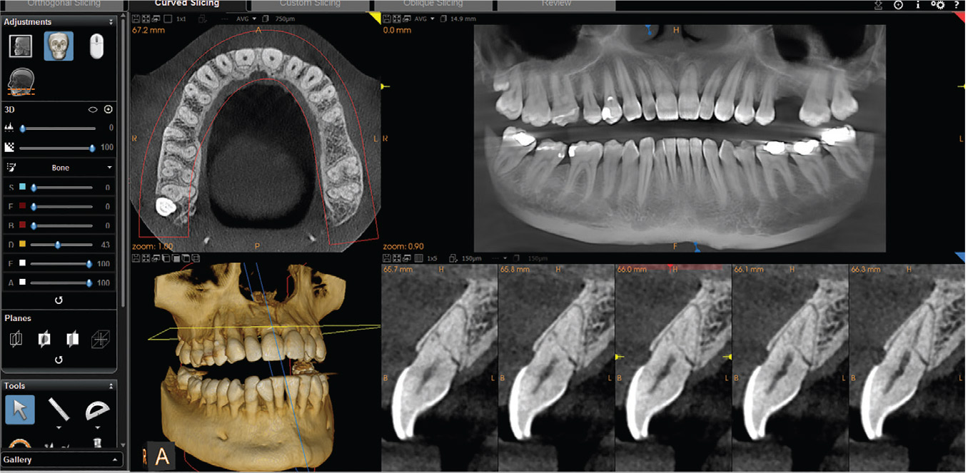 CBCT Dental Imaging Market Trends and Forecast | Research Report covers Global Industry Size & Share