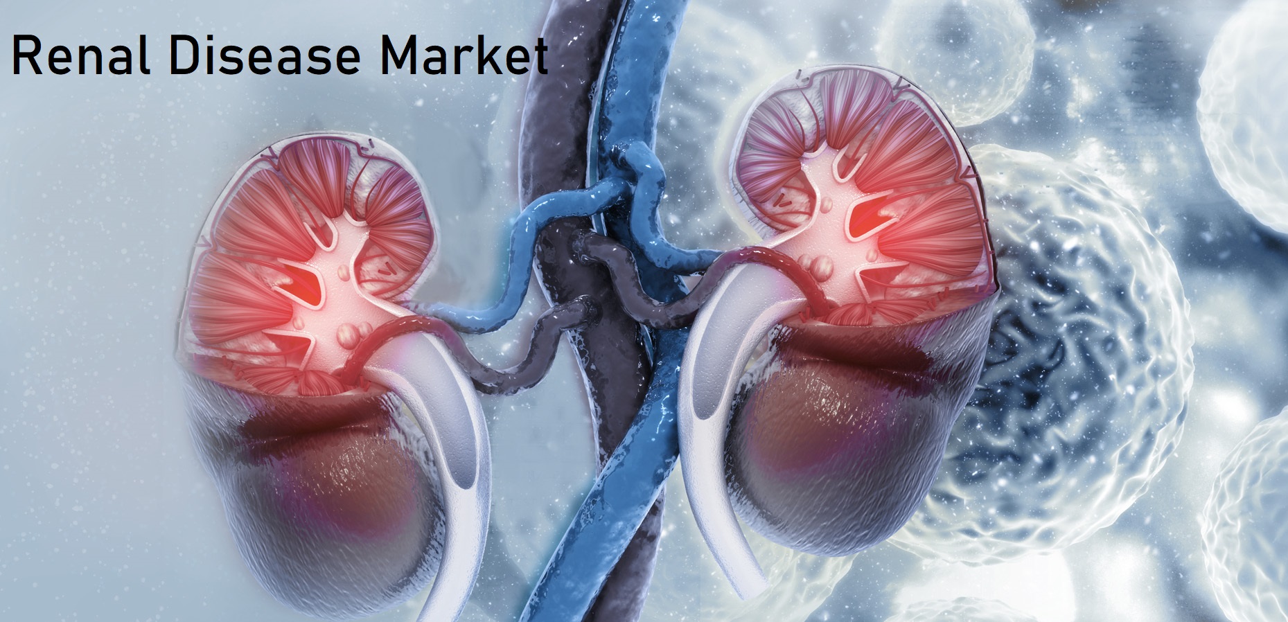 Renal Disease Market Share to Cross USD 89.07 Billion Valuation By 2030