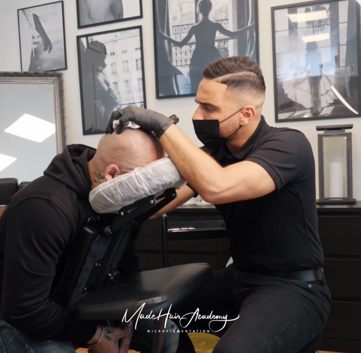 Protecting Your Scalp Micropigmentation During Summer