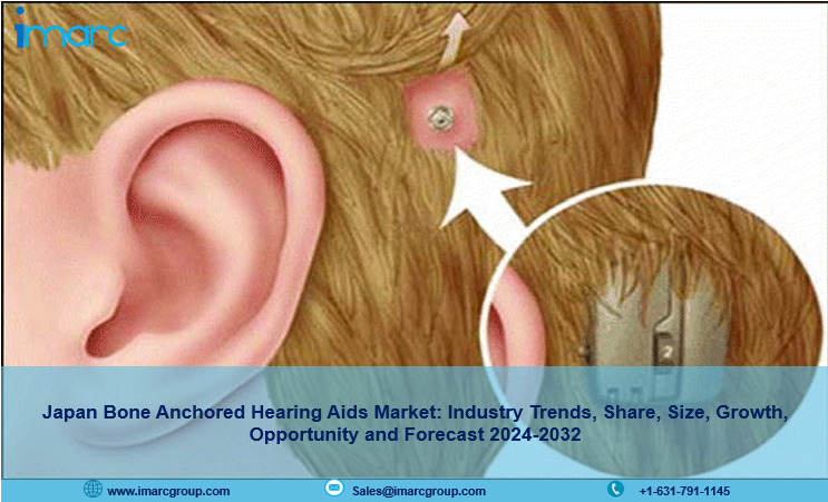 Japan Bone Anchored Hearing Aids Market Trends, Size, Growth, Demand And Forecast 2024-2032