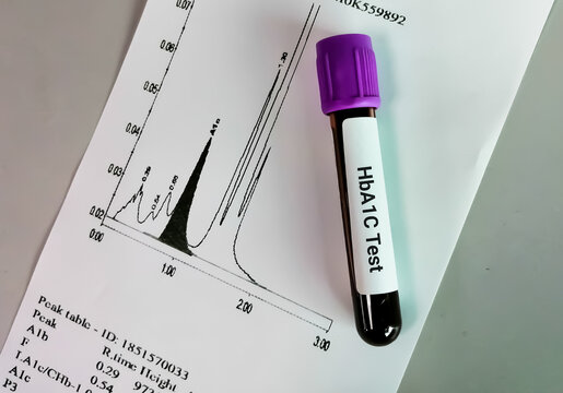 Blood Tests: Understanding HbA1c and TSH for Optimal Health