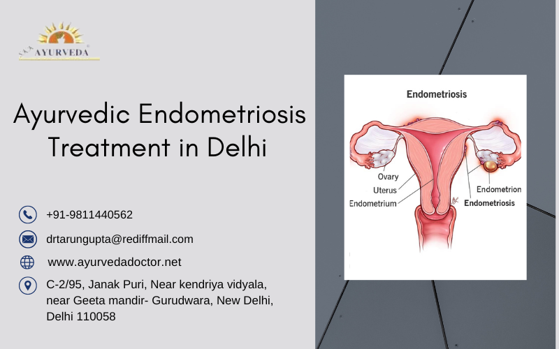 Empowering Wellness: Dr. Rani Gupta’s Comprehensive Ayurvedic Endeavor in Endometriosis Treatment, Delhi