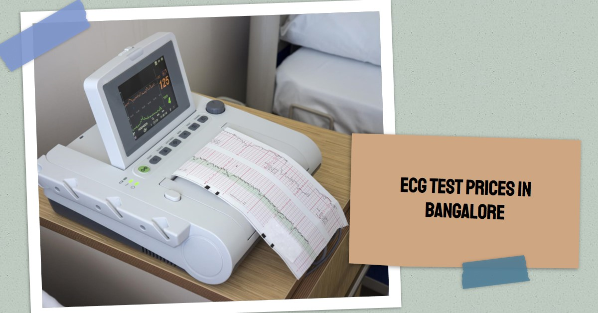Understanding ECG Test Prices in Bangalore: A Comprehensive Guide