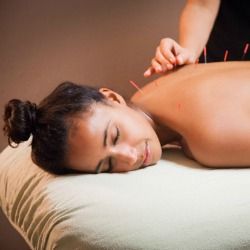 Dry Needling vs Acupuncture: Understanding the Differences