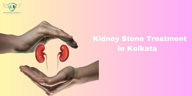 Beyond Home Remedies: Exploring Medical Treatment Options for Kidney Stones