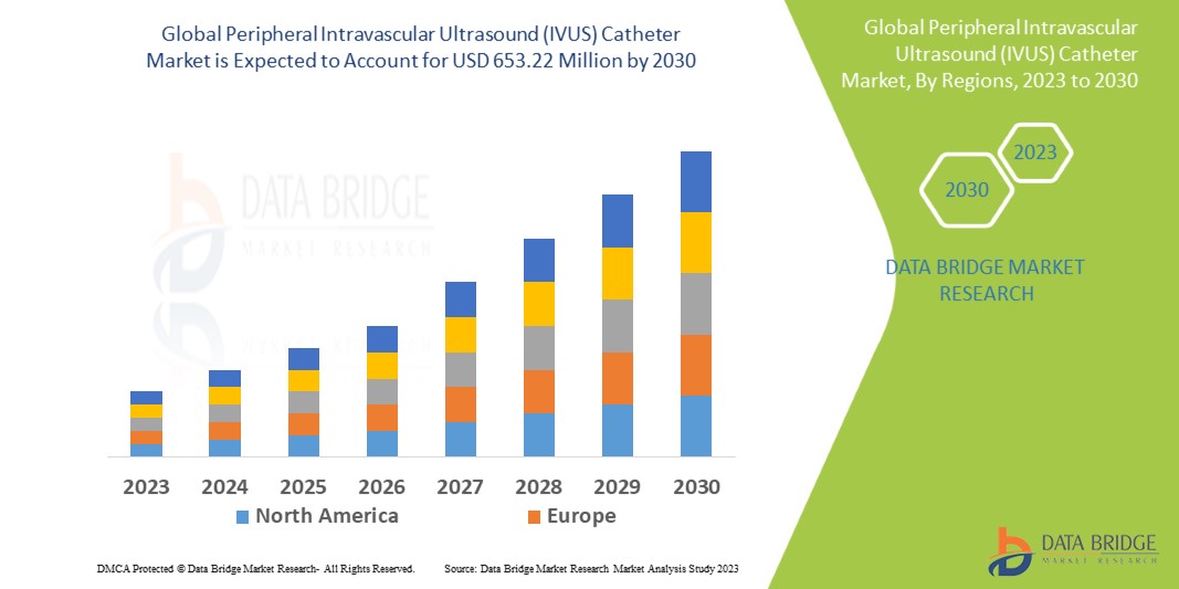 Peripheral Intravascular Ultrasound (IVUS) Catheter Market Overview, Growth Analysis, Trends and Forecast By 2030