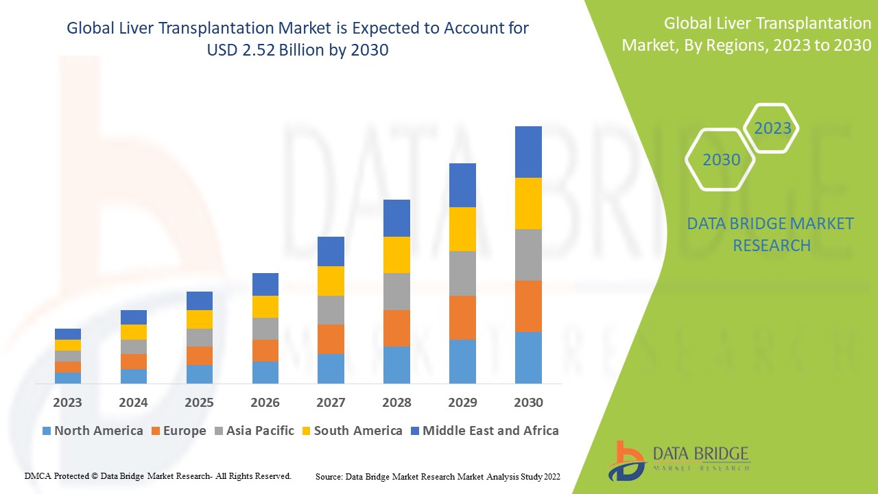 Liver Transplantation Market ,trends, share, industry size, growth, demand, opportunities and forecast by 2030